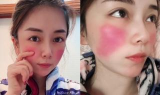 妈妈阳性宝宝生下来就发烧