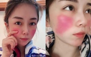 宝宝发烧有哪些原因 妈妈阳性宝宝生下来就发烧